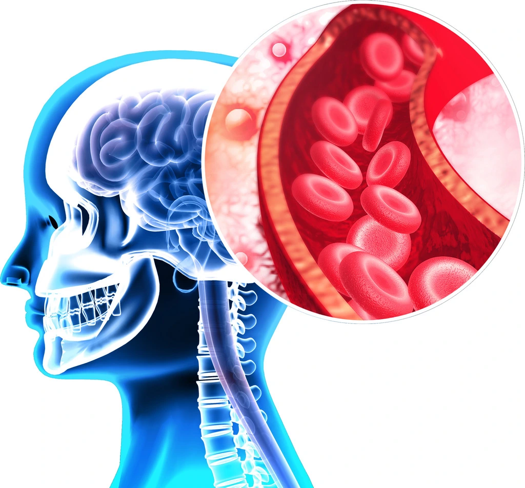 Beynin eksik molekülü demans tedavisinde yeni umut
